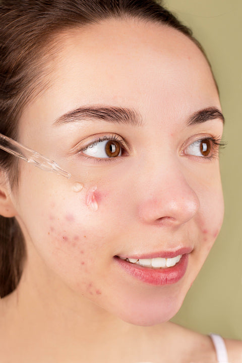 Close-up of a woman applying facial serum with a dropper