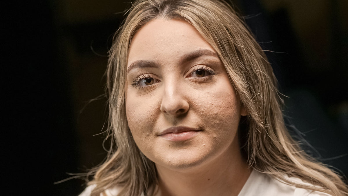 Close-up portrait showing natural skin texture and pores