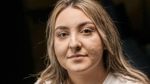 Close-up portrait showing natural skin texture and pores