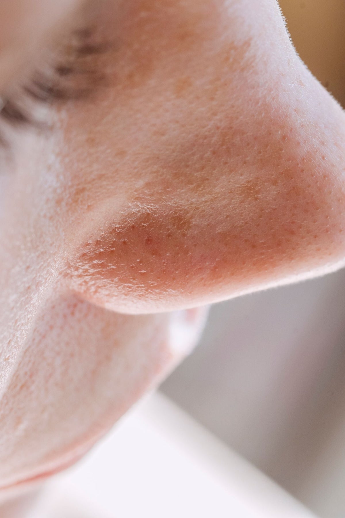 Close-up of natural nose skin texture and pores, Angela Roma via Pexels