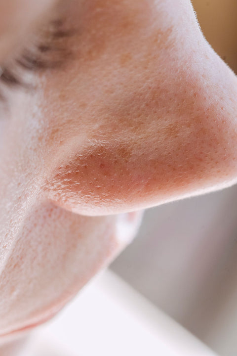 Close-up of natural nose skin texture and pores, Angela Roma via Pexels